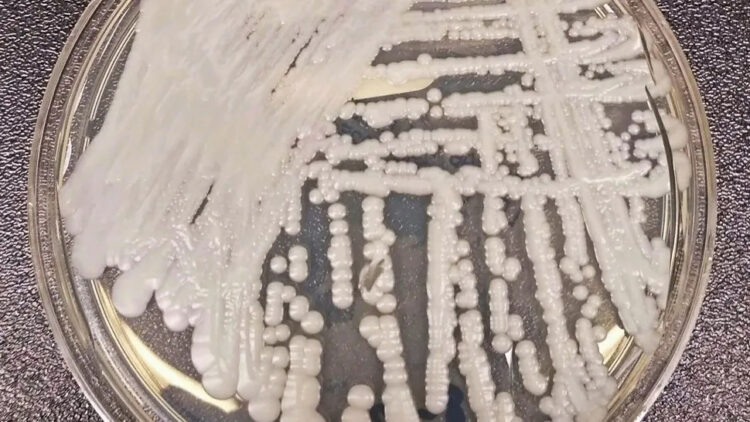 Detectan dos casos de un superhongo en CABA: qué es y qué síntomas tiene